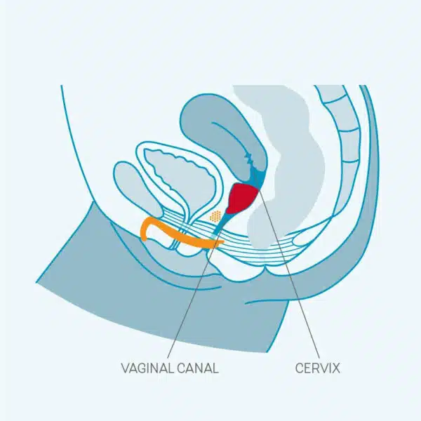 Menstrual Silikon Regli Kabı 30ml - Görsel 6