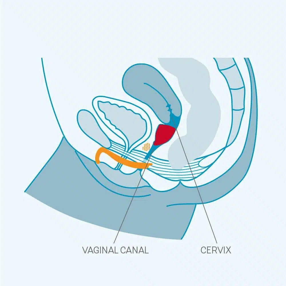 Menstrual Silikon Regli Kabı 20ml - Görsel 4